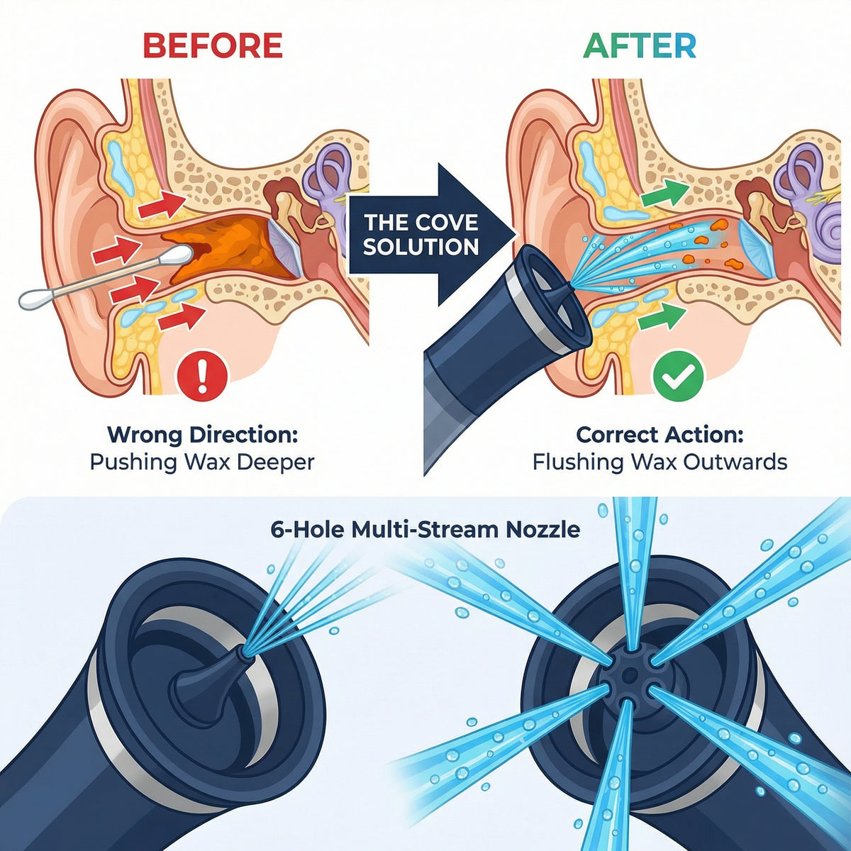 Cove™ Ear Irrigation Kit