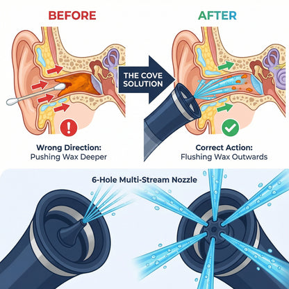 Cove™ Ear Irrigation Kit